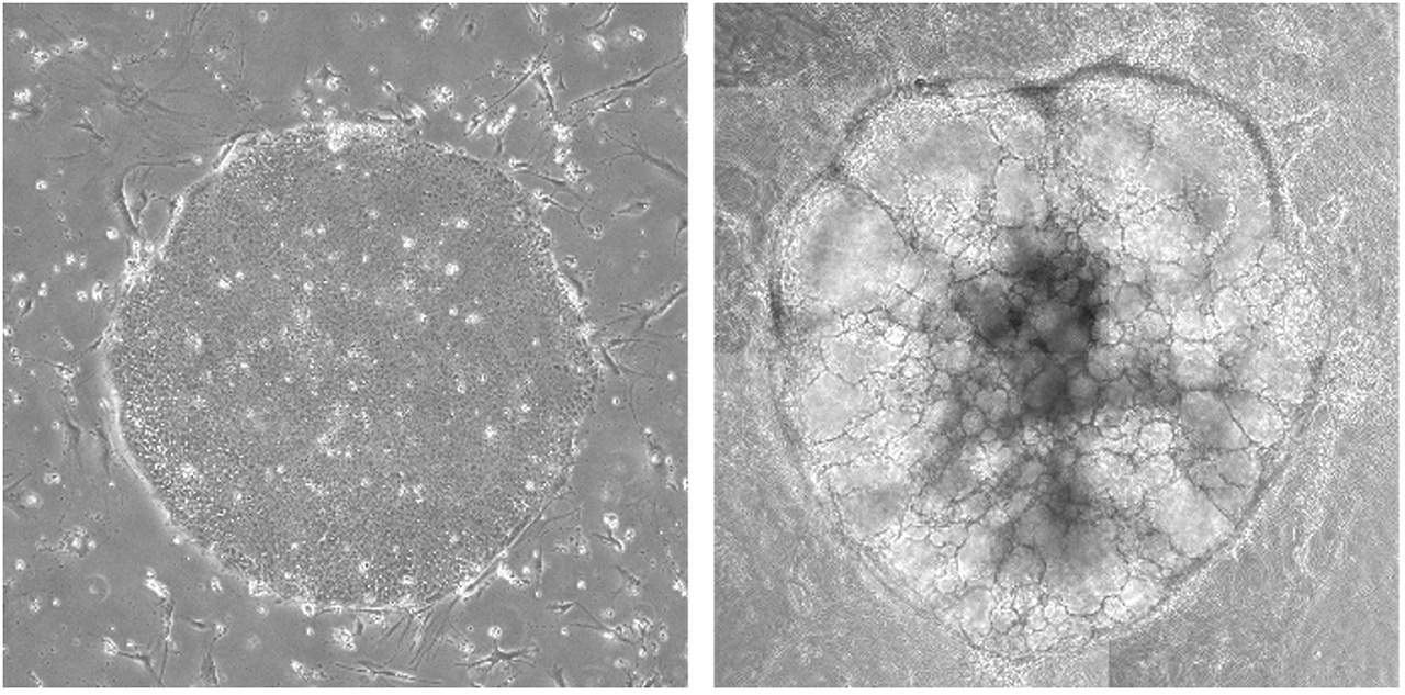 図1 ヒトiPS細胞（左）とヒトiPS細胞から作成したオルガノイド（右）