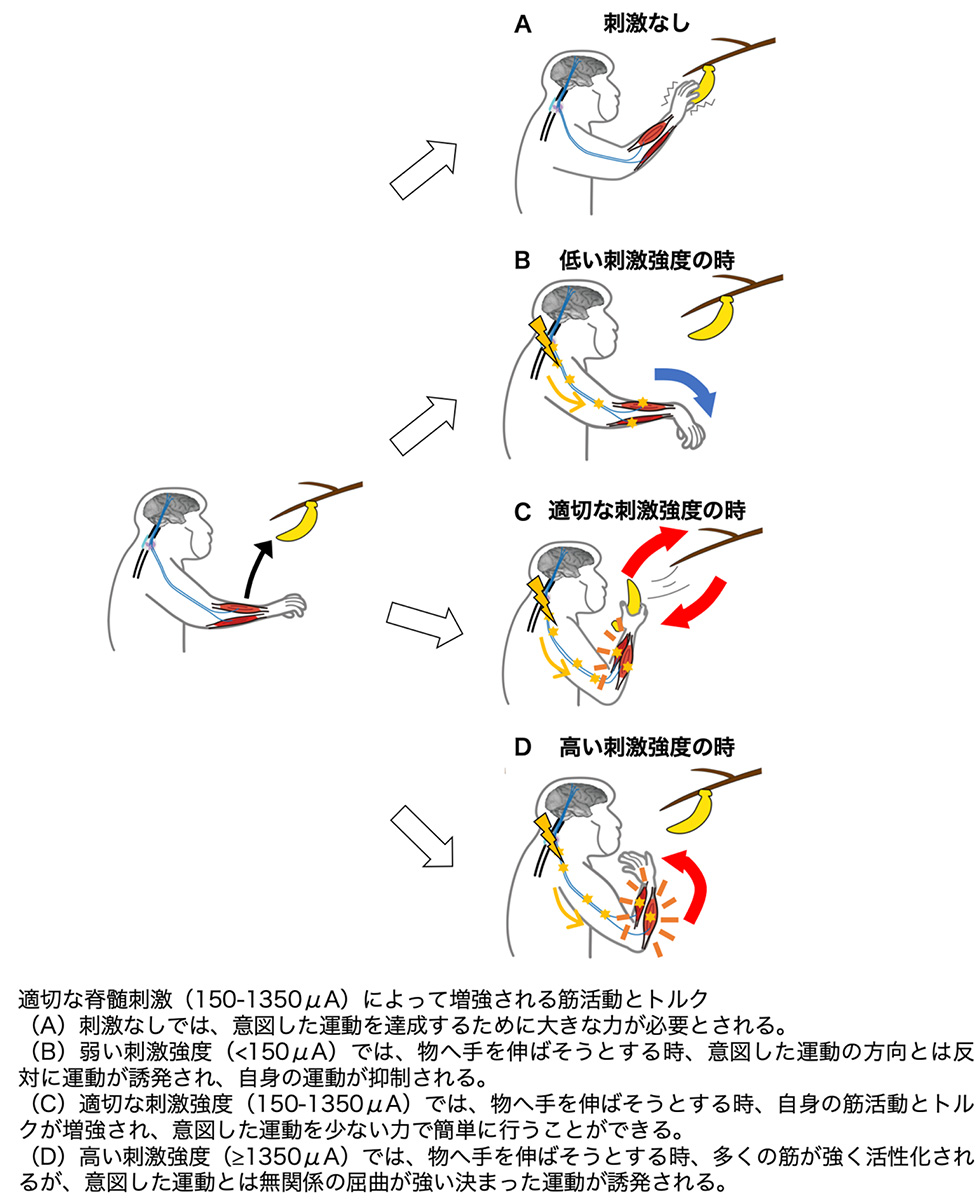 適切な脊髄刺激によって増強される筋活動とトルク