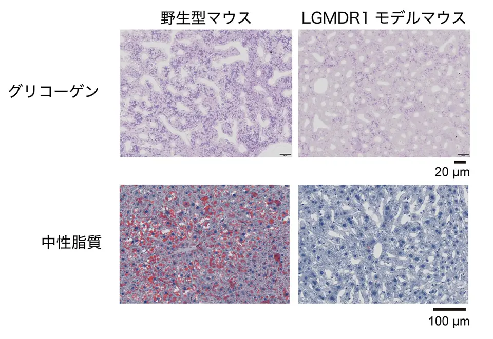図2 LGMDR1モデルマウスではエネルギー源（赤く染色される）の蓄積が抑制されていた